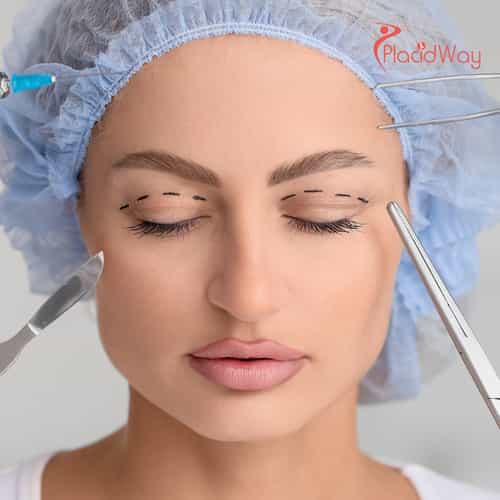 Thread Lift Treatments in Korean Clinics for Subtle, Non-Surgical Facial Tightening